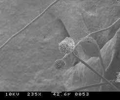 Aspergillus-associated_disease